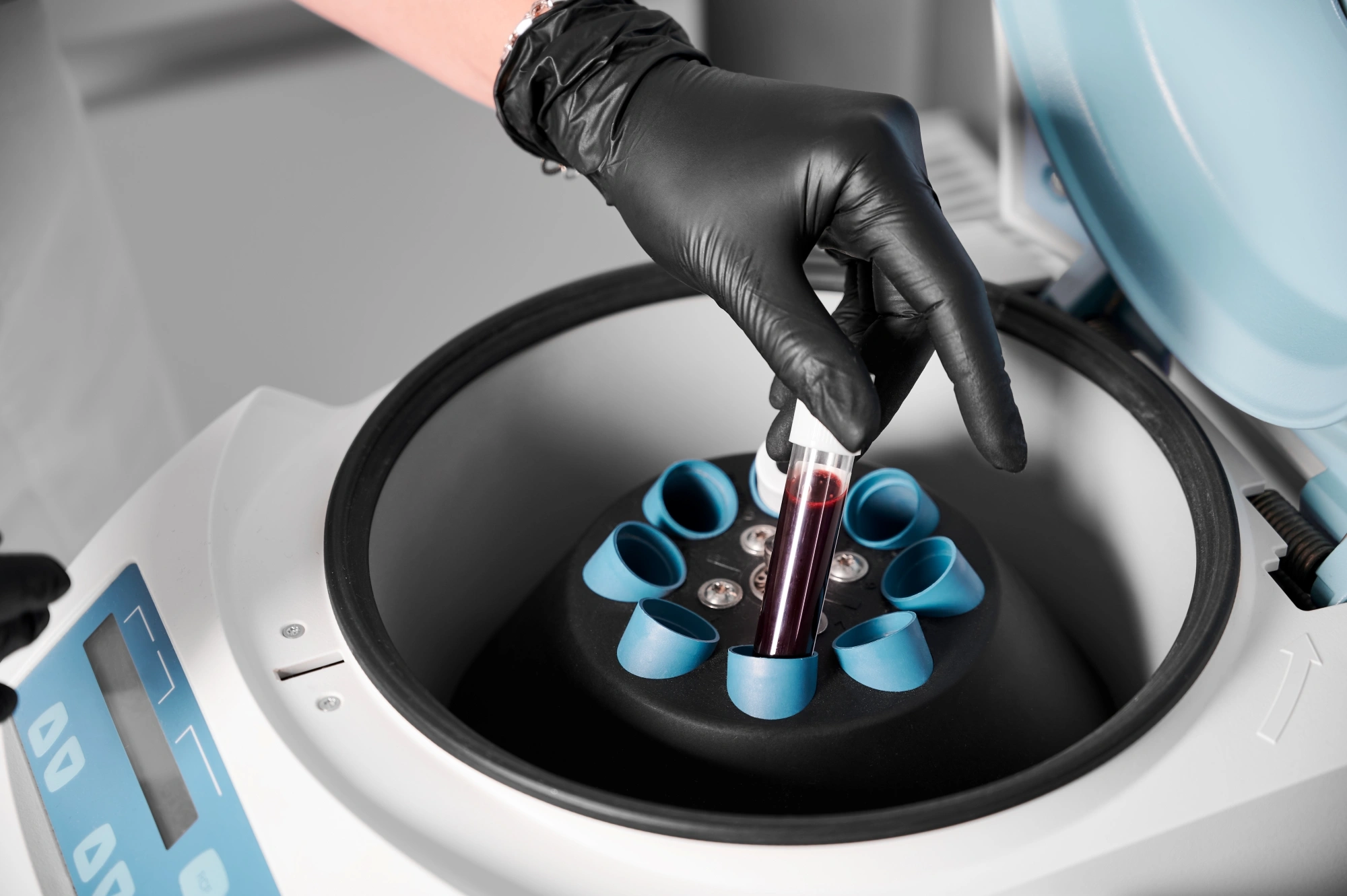 PRP 2