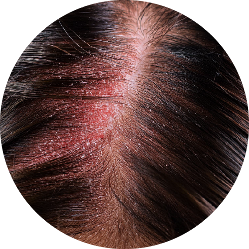 Scalp issues